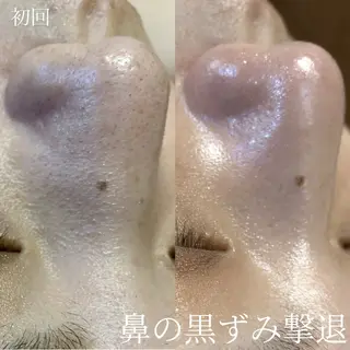 艶肌デトックス🫧 Samiraのエステ・リラクイメージ