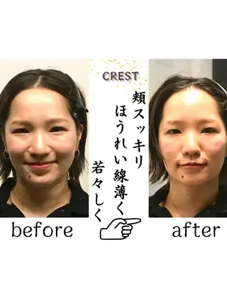 美容整体.小顔矯正 CREST佐藤大雅のエステ・リラクイメージ