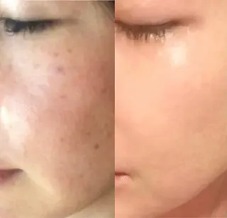 facial salon D 吉沢のエステ・リラクイメージ