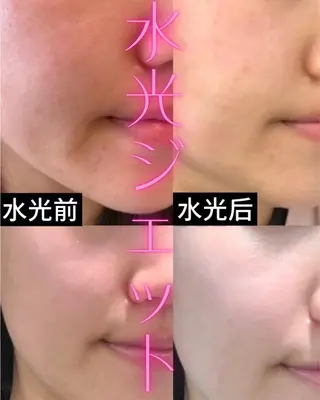 ネイル 愛維美水光専門店 川崎彩鳳のエステ・リラクイメージ