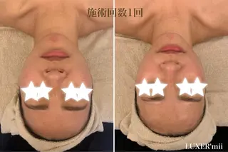 小顔コルギ miiのエステ・リラクイメージ