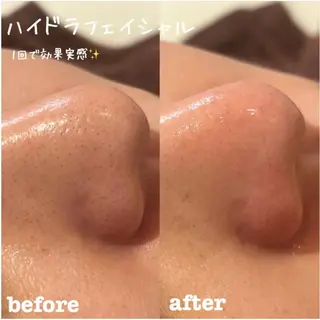 美養HAREHADA minamiのエステ・リラクイメージ