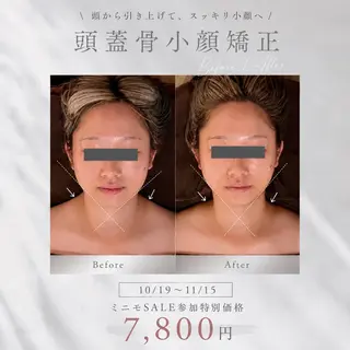 kogao&head Linoasのエステ・リラクイメージ