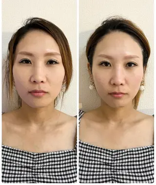 肌管理 OGUMOのエステ・リラクイメージ
