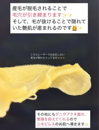 毛穴開き黒ずみ ニキビ特化💆♀️のエステ・リラクイメージ