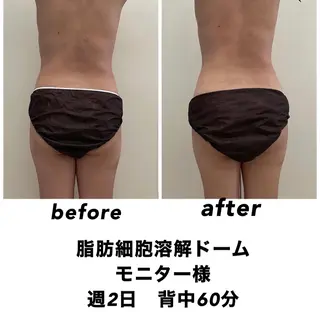 ネイル・エステサロン UILANIのエステ・リラクイメージ
