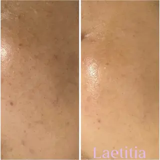 レティティア (Laetitia)のエステ・リラクイメージ