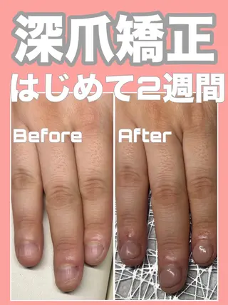 ネイル nail salon petillantのネイルデザイン