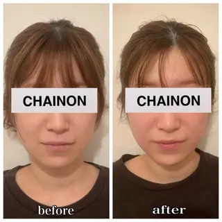 CHAINON 大和田のエステ・リラクイメージ