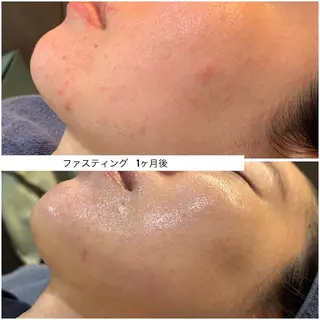 leolo武蔵浦和 肌質改善&脱毛のエステ・リラクイメージ