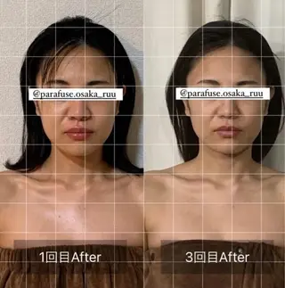 【頭痛、睡眠改善】 salon RUUのエステ・リラクイメージ