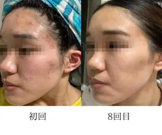 Esthetic ReTweetのエステ・リラクイメージ