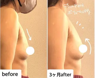 育乳痩身バストアップ サロン　つばききよらのエステ・リラクイメージ