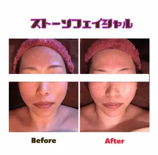 代表 MOMOのエステ・リラクイメージ