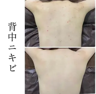 ハーブピーリング専門 BIOPLUS+川崎のエステ・リラクイメージ