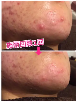 ロング カラー パーマ ヘアアレンジ メンズ キッズ ネイル マツエク・マツパ 痩身&ボディ 結果出し🌟丹野のエステ・リラクイメージ