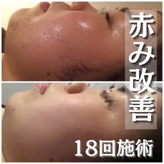 ミディアム カラー パーマ ヘアアレンジ メンズ キッズ ネイル マツエク・マツパ アイブロウ ニキビ・肌質改善専門 ♡人生が変わるサロンのエステ・リラクイメージ