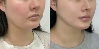 マツエク・マツパ 愛維美水光専門店 川崎彩鳳のエステ・リラクイメージ