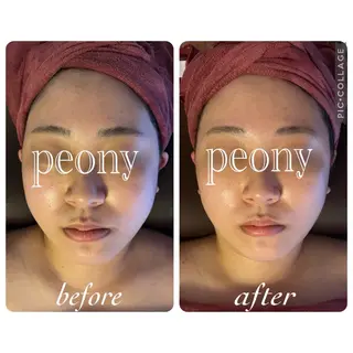 デトックス美容専門 サロンpeonyのエステ・リラクイメージ
