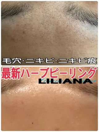 LILIANA ☆YURIのエステ・リラクイメージ