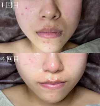 beauty salonWのエステ・リラクイメージ