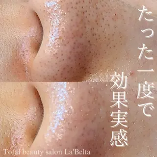 ラベルタ 上野のマツエク・マツパデザイン