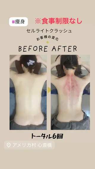 セルライトクラッシュ &腸もみ+骨盤矯正のその他イメージ