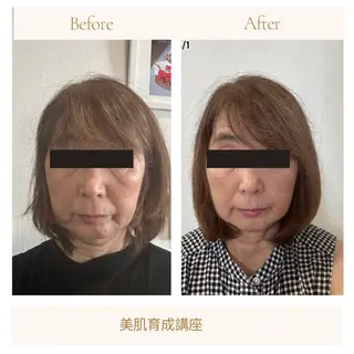 小顔・たるみ改善 ラディアントミューズのエステ・リラクイメージ