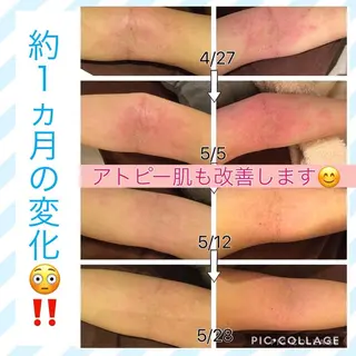 ミディアム カラー パーマ ヘアアレンジ メンズ キッズ ネイル マツエク・マツパ ニキビ・肌質改善専門 ♡人生が変わるサロンのエステ・リラクイメージ