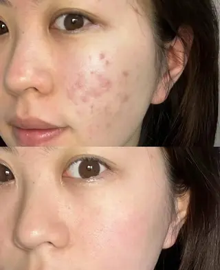 ネイル 愛維美水光専門店 川崎彩鳳のエステ・リラクイメージ