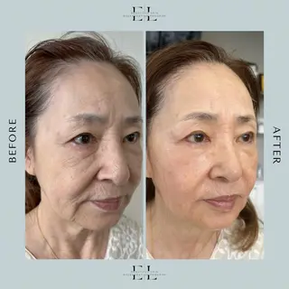 White labo 須谷のエステ・リラクイメージ