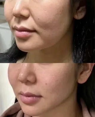 愛維美水光美肌専門店 メンズレディースokのエステ・リラクイメージ