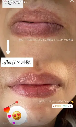 【ローマピンク施術】 Kaoのその他イメージ