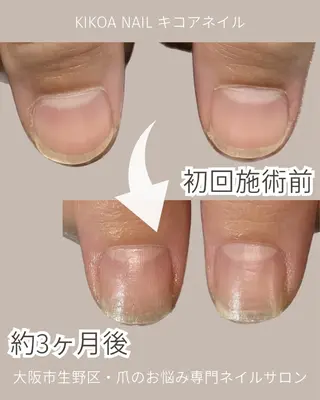 ネイル KIKOA NAIL キコアネイルのネイルデザイン