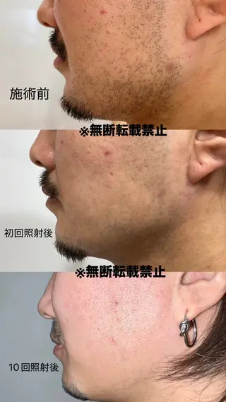 メンズ キッズ 親子脱毛サロン ReOluのエステ・リラクイメージ