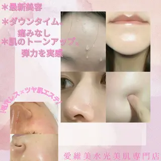 愛維美水光美肌専門店 メンズレディースokのエステ・リラクイメージ