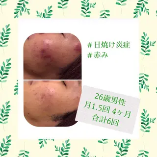 ミディアム カラー パーマ ヘアアレンジ メンズ キッズ ネイル マツエク・マツパ ニキビ・肌質改善専門 ♡人生が変わるサロンのエステ・リラクイメージ