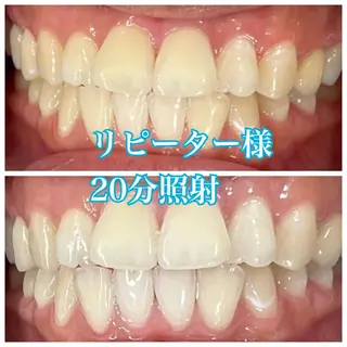 ホワイトニング🦷 ネイル💅LEAのその他イメージ