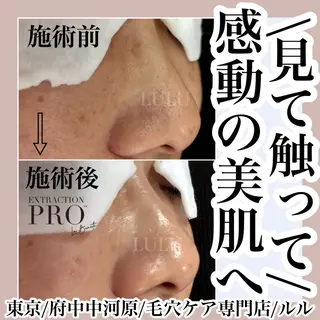 LULU ルルのエステ・リラクイメージ