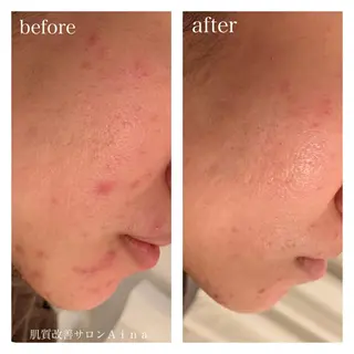 ロング カラー パーマ ヘアアレンジ メンズ キッズ マツエク・マツパ ニキビ跡専門サロン Ainaのエステ・リラクイメージ