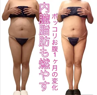 痩身ダイエット&小顔 🩷アールズスリムのエステ・リラクイメージ