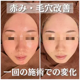 ミディアム カラー パーマ ヘアアレンジ メンズ キッズ ネイル マツエク・マツパ アイブロウ ニキビ・肌質改善専門 ♡人生が変わるサロンのエステ・リラクイメージ