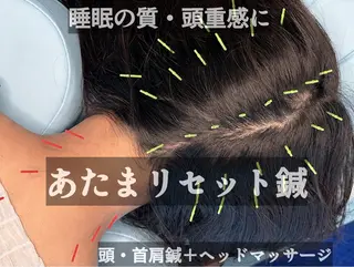 渋谷｜小顔美容鍼・ 首肩こり・山崎のエステ・リラクイメージ
