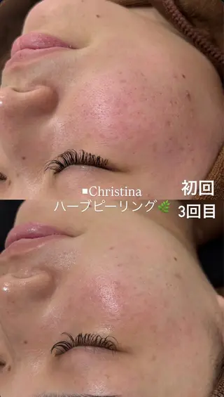 志倉 星来のエステ・リラクイメージ