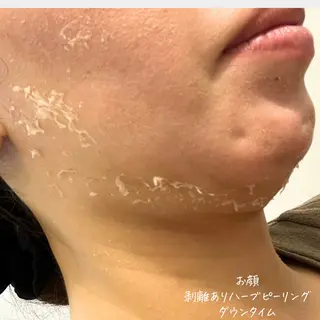 肌質改善サロン renew/ウエキのエステ・リラクイメージ
