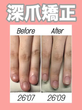 ネイル nail salon petillantのネイルデザイン