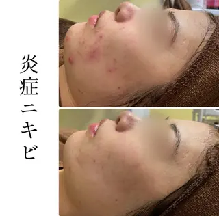ハーブピーリング専門 BIOPLUS+川崎のエステ・リラクイメージ