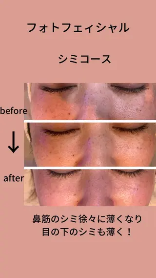 エステfreep takamoriのエステ・リラクイメージ