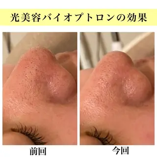 Bellesthe (ベルエステ)のエステ・リラクイメージ