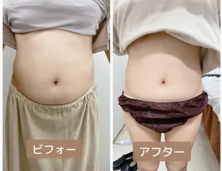 ショールームエステ becoのエステ・リラクイメージ